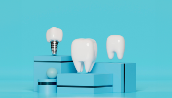 All About the Different Types of Dental Implants